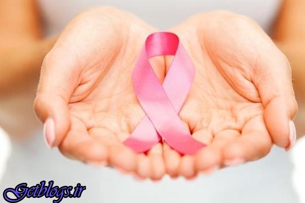 ارتباط کم کردن حجم ماهیچه ها و زیاد کردن فوت در مبتلایان سرطان سینه