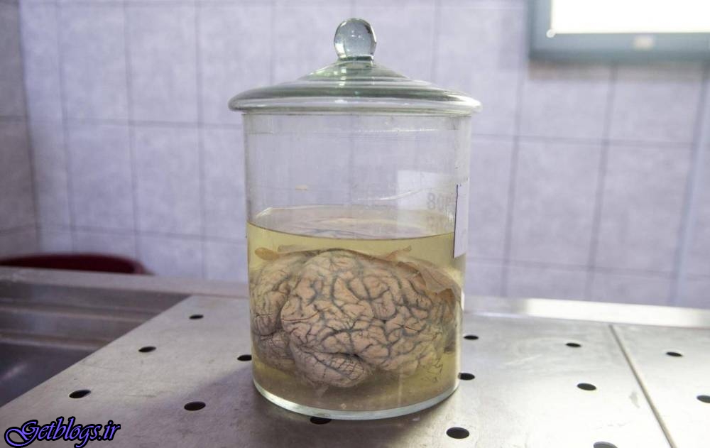 محققان مغز خوک را در خارج از بدن زنده نگاه داشتند