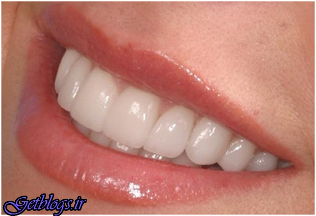 خمیردندانی جهت برطرف پوسیدگی های سطحی دندان
