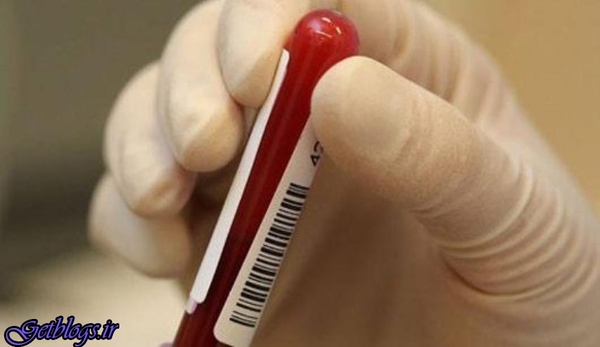 انقلاب در آزمایش خون با تشخیص ۱۰ نوع سرطان