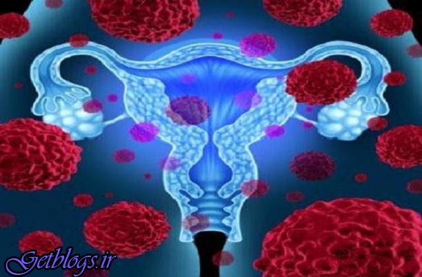 اختلال در باروری ، شیوع سندروم تخمدان در زنان و دختران
