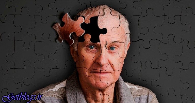 عامل ژنتیکی بیماری آلزایمر شناسایی شد