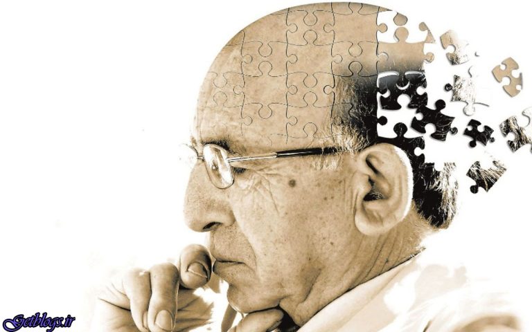 توقف آلزایمر با یک مولکول تازه