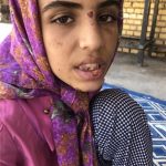 عکس) + از شکستن دندان با چکش تا بستن لبهای دختر فرزند ۱۲ ساله با چسب حراراتی (