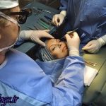 دلایل وفور جراحیهای قشنگی در کشور عزیزمان ایران