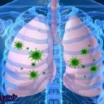 کلسترول خوب خطر ذات الریه و التهاب روده را زیاد کردن می دهد