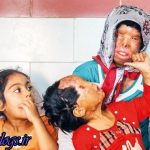 عکس + مرد اسیدپاش پای چوبه دار